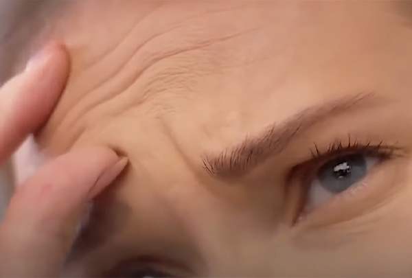Контурная пластика лба