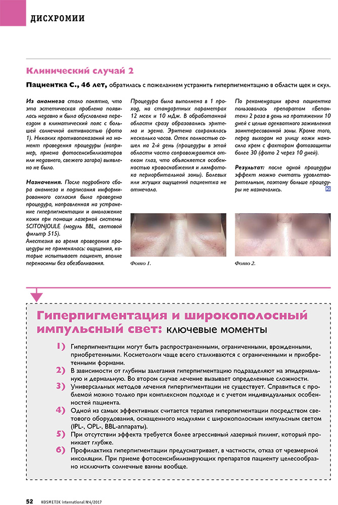 Коррекция гиперпигментации