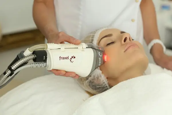 Лазерный пилинг лица в Москве