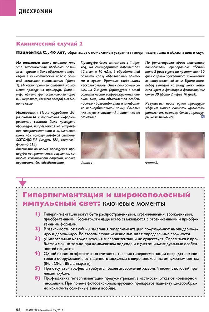 Коррекция гиперпигментации